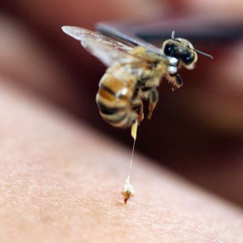 Пчёлы в медицине (пчелиный яд)